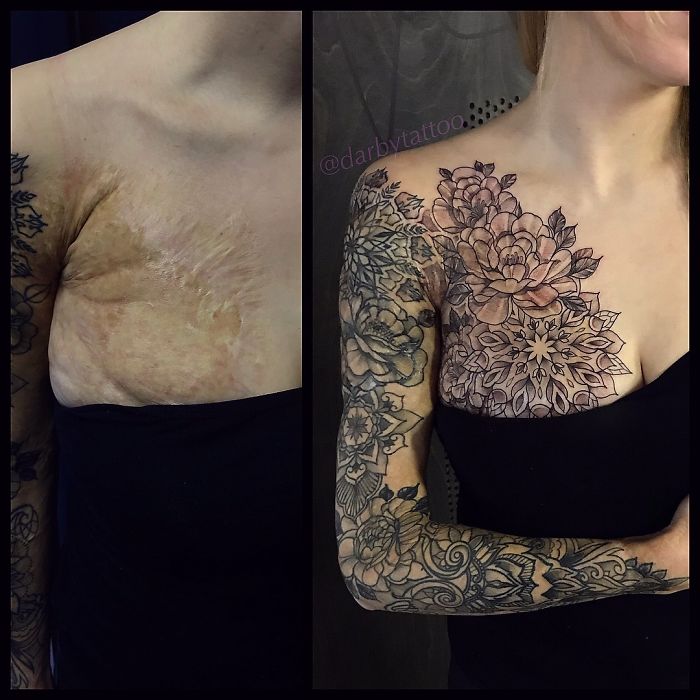Tatuagens que transformaram manchas e cicatrizes em obras de arte