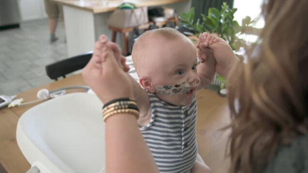 Bebé mais prematuro do Mundo fez 1 ano: Nasceu com 285g e venceu todas as probabilidades