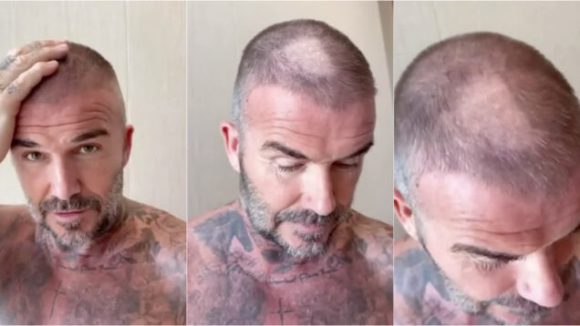 Beckham sofreu acidente ao cortar o cabelo e anda levou gozo da esposa