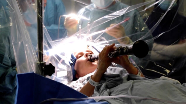 Mulher com Parkinson toca clarinete durante cirurgia ao cérebro e emociona equipa médica